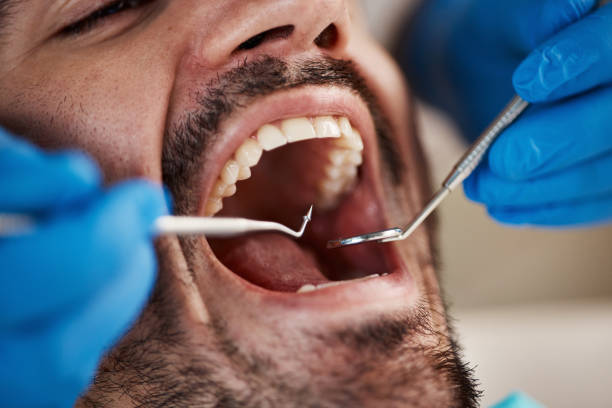 Best Knocked-Out Tooth Emergency  in Crestwood, IL